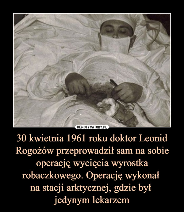 30 kwietnia 1961 roku doktor Leonid Rogożów przeprowadził sam na sobieoperację wycięcia wyrostka robaczkowego. Operację wykonał na stacji arktycznej, gdzie był jedynym lekarzem –  