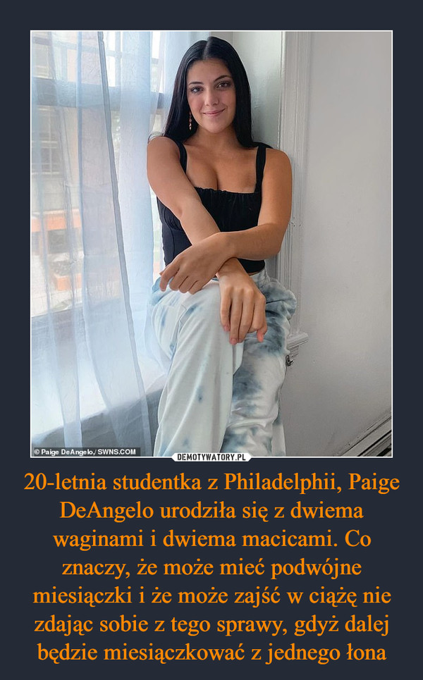 20-letnia studentka z Philadelphii, Paige DeAngelo urodziła się z dwiema waginami i dwiema macicami. Co znaczy, że może mieć podwójne miesiączki i że może zajść w ciążę nie zdając sobie z tego sprawy, gdyż dalej będzie miesiączkować z jednego łona