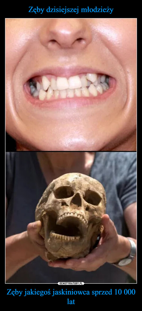 Zęby jakiegoś jaskiniowca sprzed 10 000 lat –  